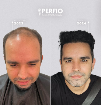 Imagem 4